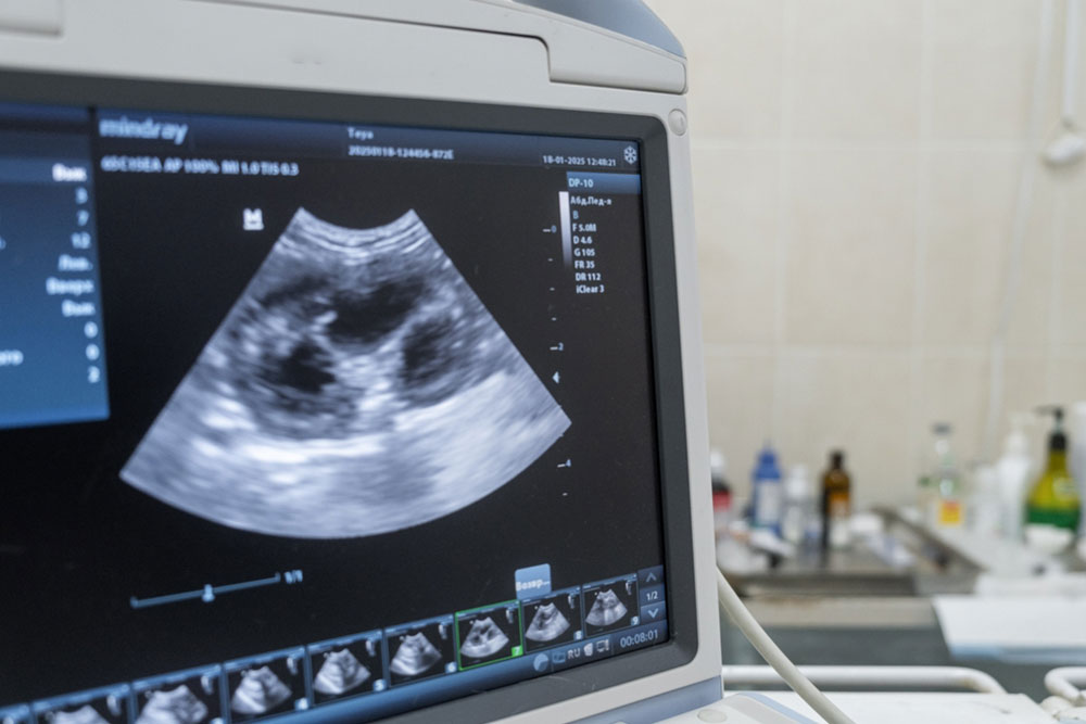 A medical ultrasound machine with a grayscale sonogram on its screen, showing internal body structures and technical parameters, with clinical supplies visible in the background.